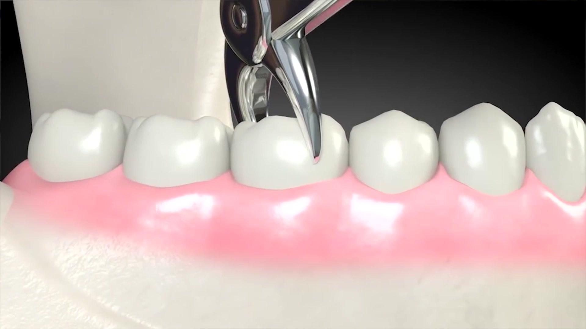 عوارض بی دندانی |کلینیک مدرن