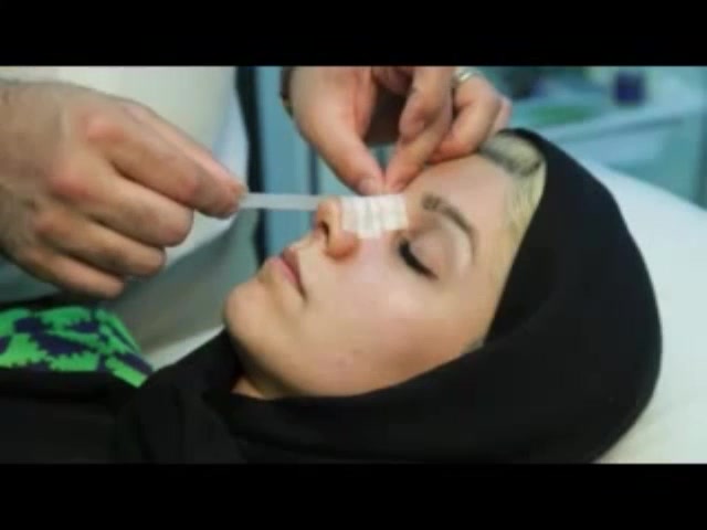 نحوه و آموزش چسب زدن بینی بعد از عمل جراحی بینی - زیبایی سنتر